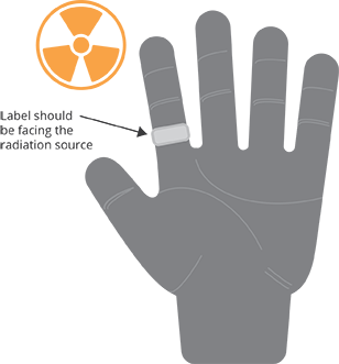 hand with dosimeter ring