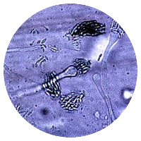 Aspergillus restrictus
